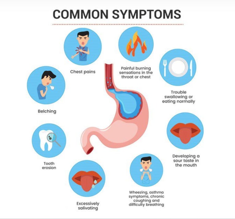 what is acid reflux symptoms | Ashcroft Pharmacy UK